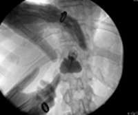 nova procedura-kl.radiologija